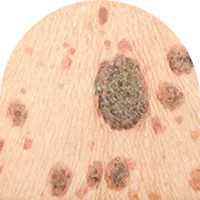 Dark Spots