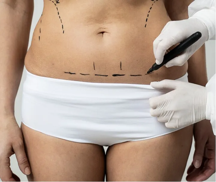Which type of Liposuction Is The Best
