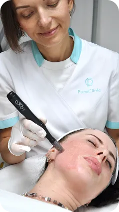 Microneedling