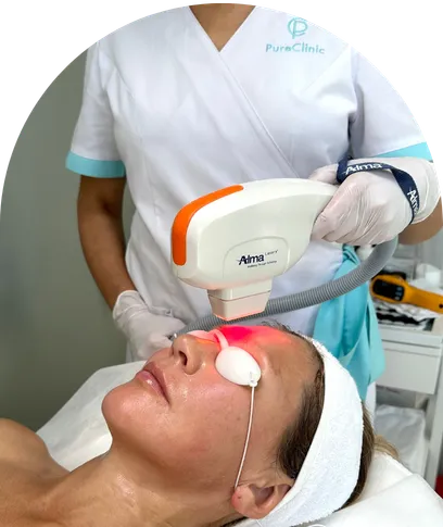 Professional using an Alma laser device for facial skin treatment