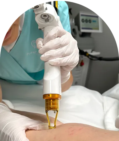 Laser treatment