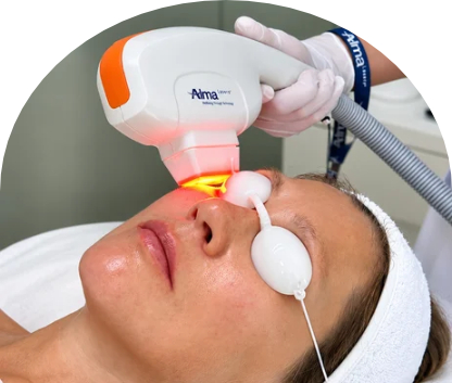 Clinical Laser Facial Treatment