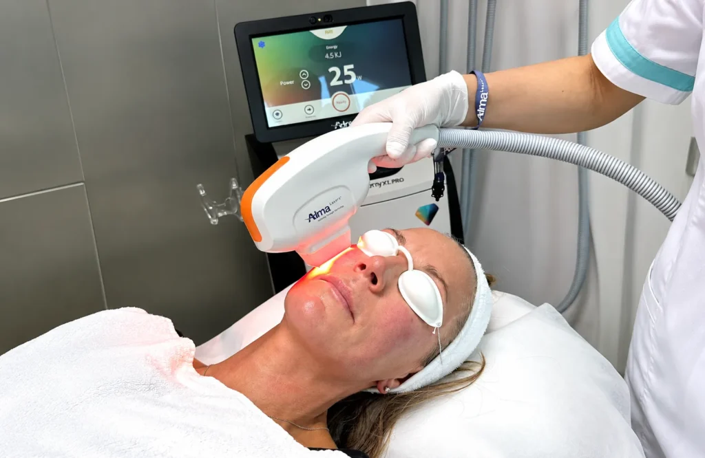 Laser Facial Treatment in Modern Clinic