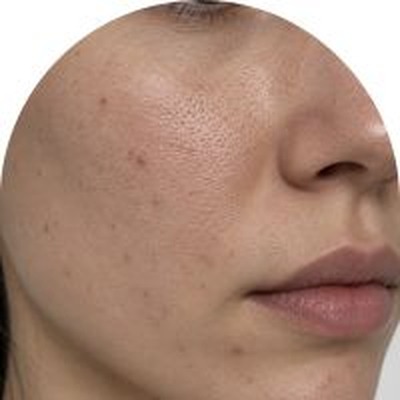 Dark Spots
