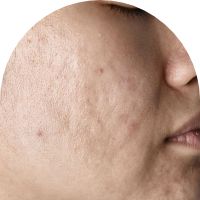 ojämn
